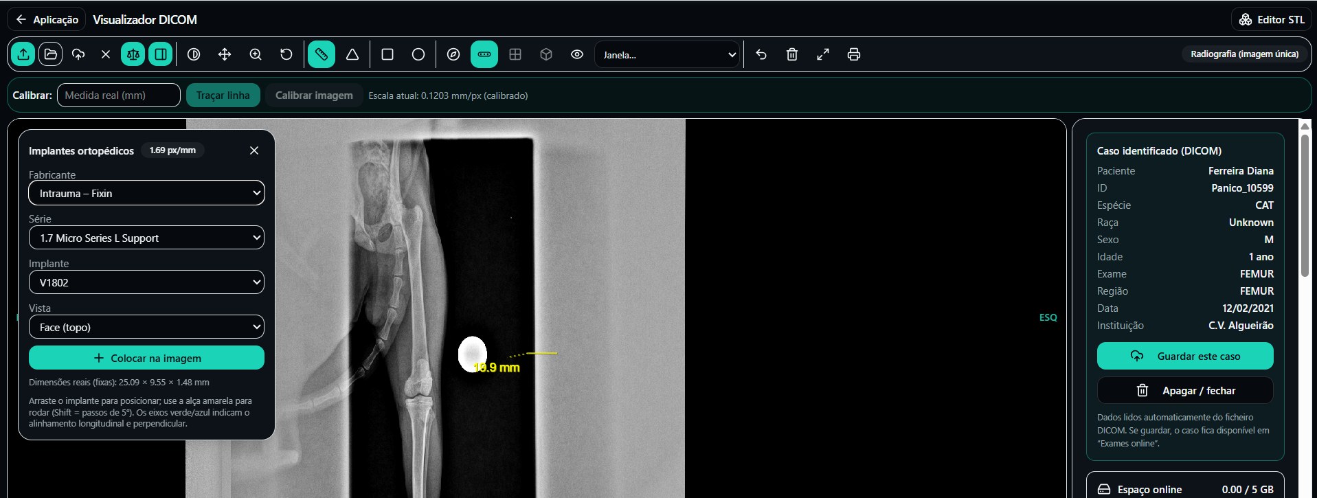 Visualizador DICOM com planeamento 2D e 3D